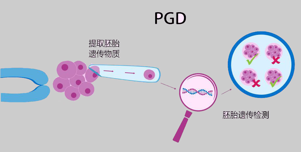 胚胎植入前遗传学诊断（PGD）.jpeg