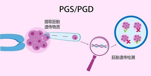 第三代试管婴儿技术.jpg